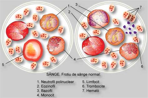 largimea distributiei trombocitare scazuta|Trombocite scăzute (trombocitopenia) 